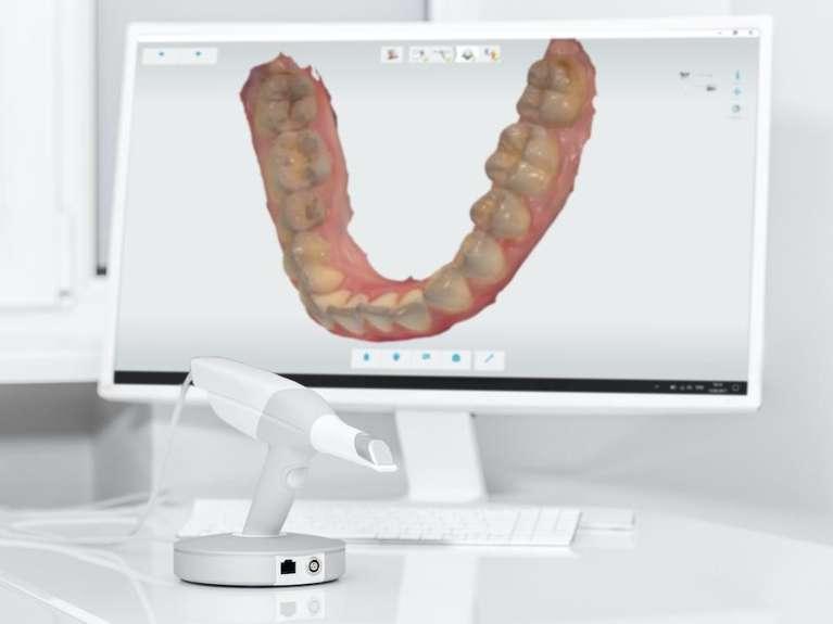 digital impression on computer screen | dentist in lakeville mn